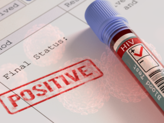 HIV cure closer than ever before after new research breakthrough
