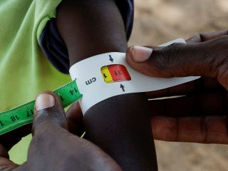 US aid cuts disrupt life-saving treatment for starving children in parts of Kenya