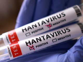 ‘This is not coronavirus,’ WHO says about hantavirus-hit ship