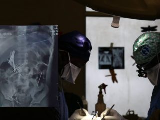 Uganda doctors remove 50 needles from boy’s stomach in alleged abuse by stepmother